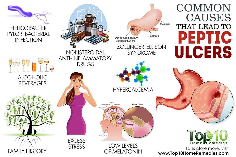 10 Common Causes that Lead to Peptic Ulcers