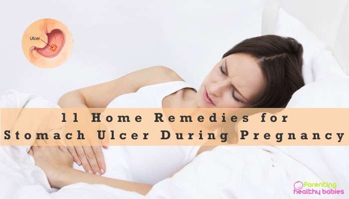 11 Effective Home Remedies for Stomach Ulcer during Pregnancy