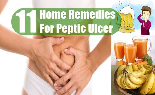 11 Home Remedies For Peptic Ulcer