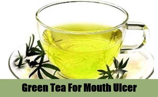 16 Home Remedies For Mouth Ulcers