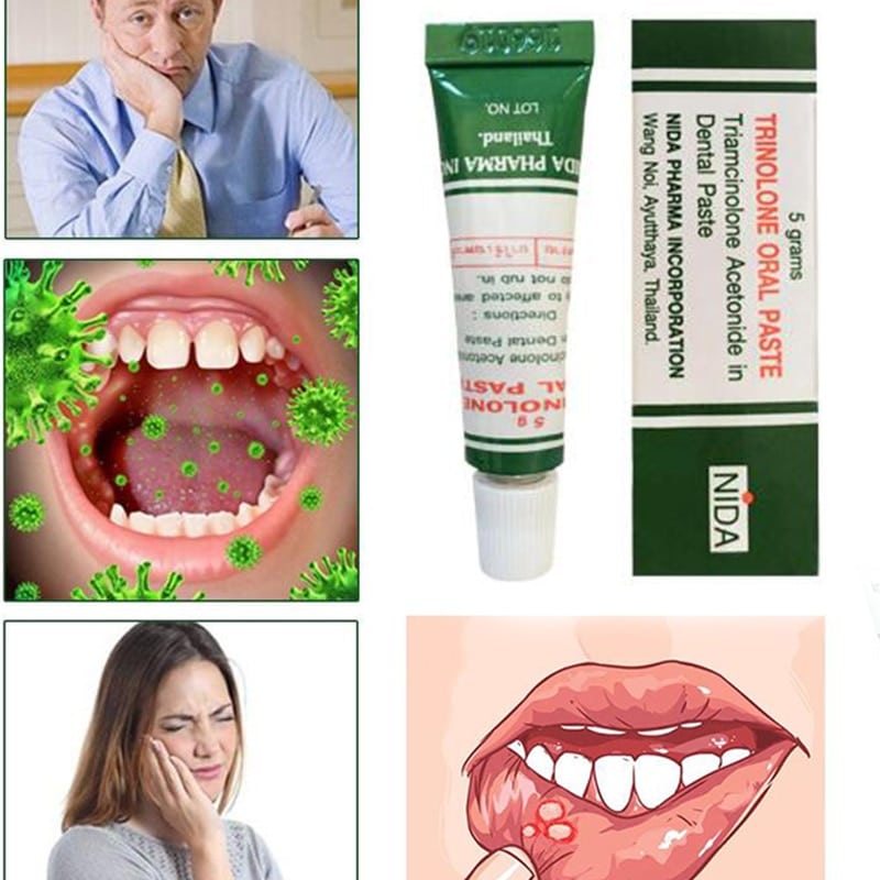 1pc Mouth Ulcer Relief Gel Natural Herbal Oral Antibacterial Cream Fast ...