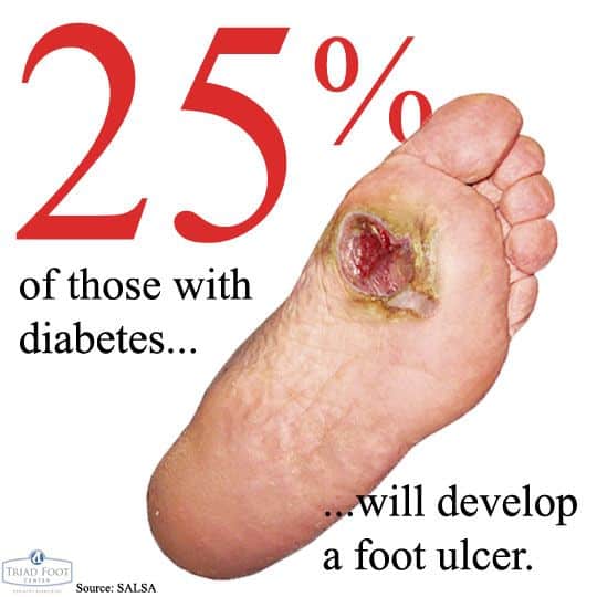 234 best images about Diabetes and Foot Health on Pinterest