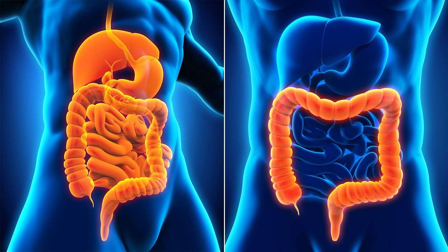 3 Key Difference Between Crohn