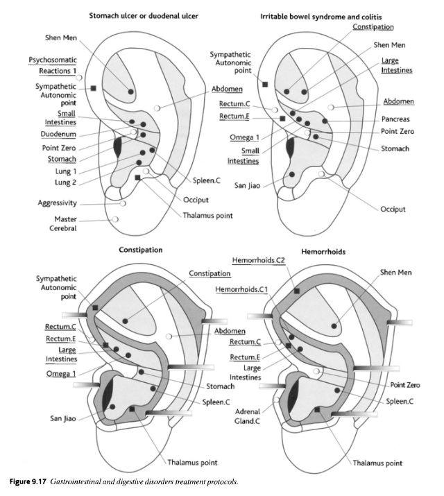 31 best Auricular Acupuncture images on Pinterest