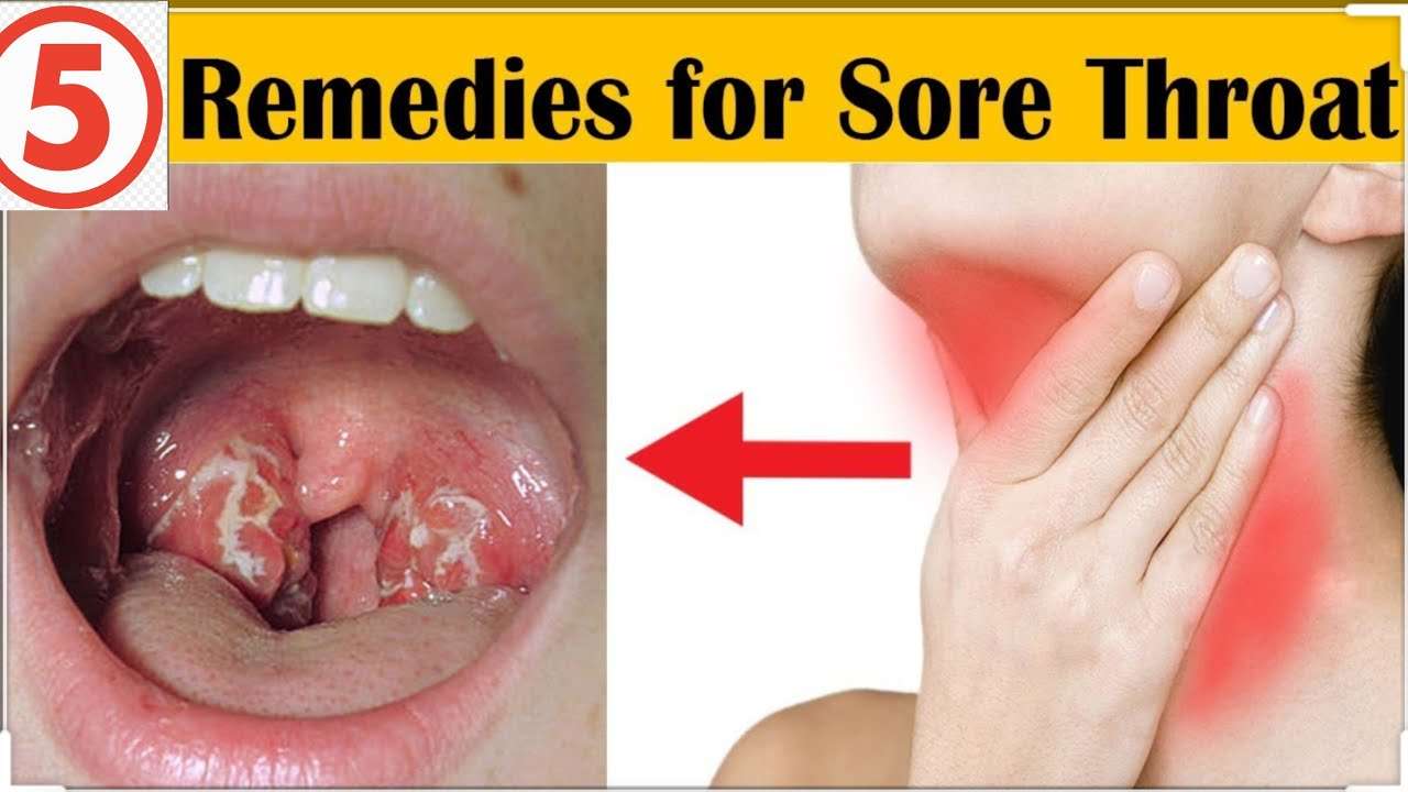 5 HOME REMEDIES FOR SORE THROAT : MED IN A MINUTE: D& N ...