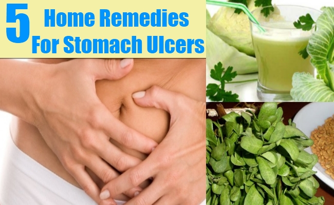 5 Stomach Ulcers Home Remedies, Natural Treatments &  Cure