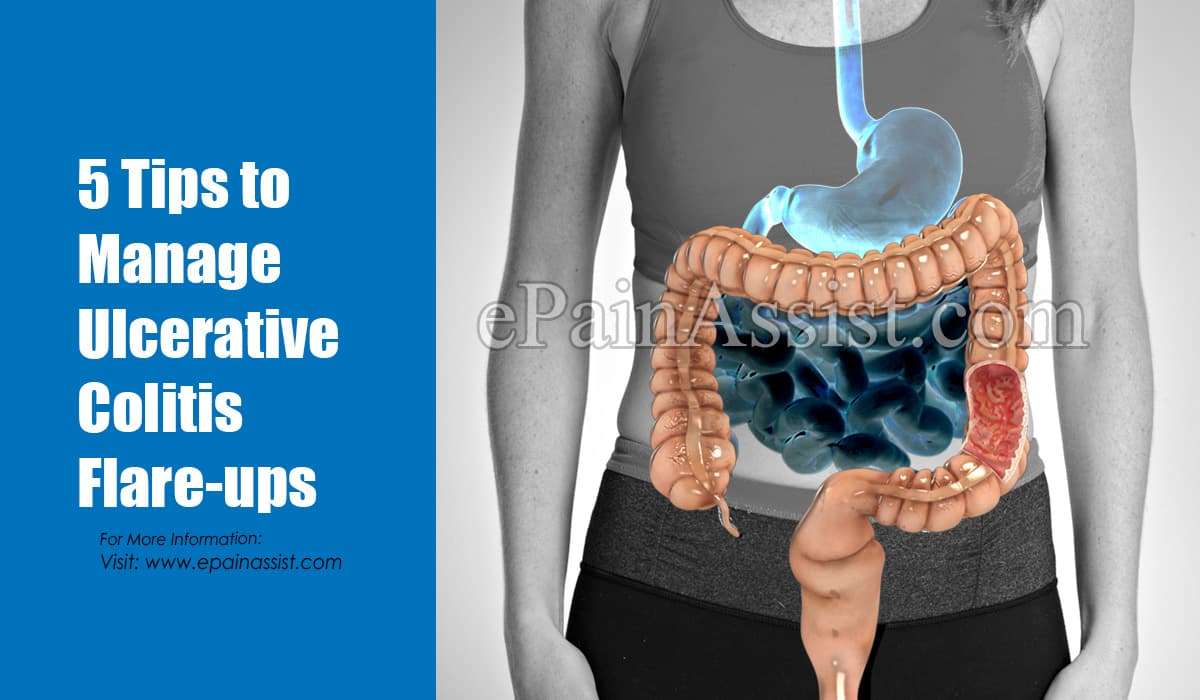 5 Tips to Manage Ulcerative Colitis Flare