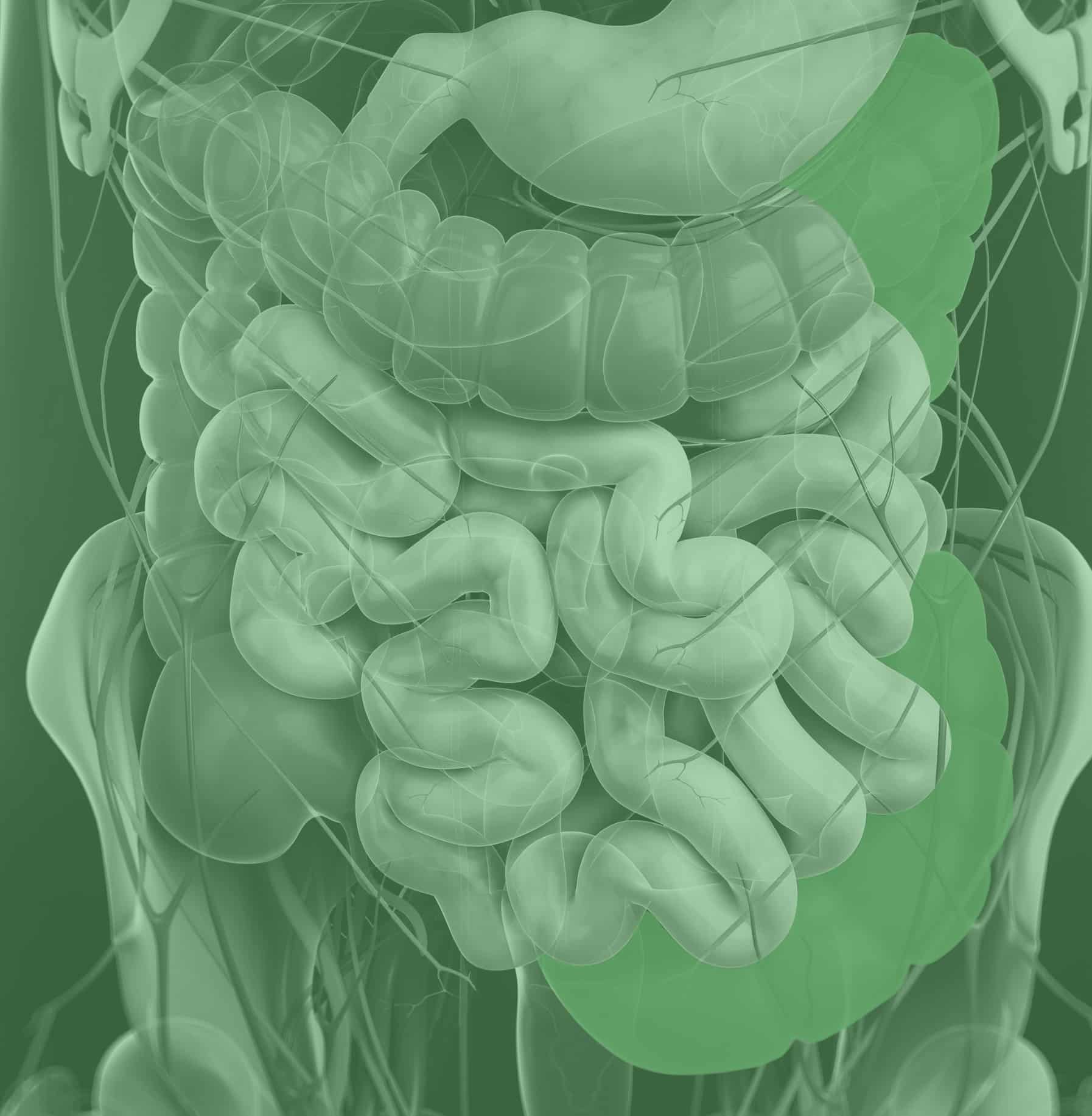 7 Biomarkers for Differentiating Between IBD and IBS