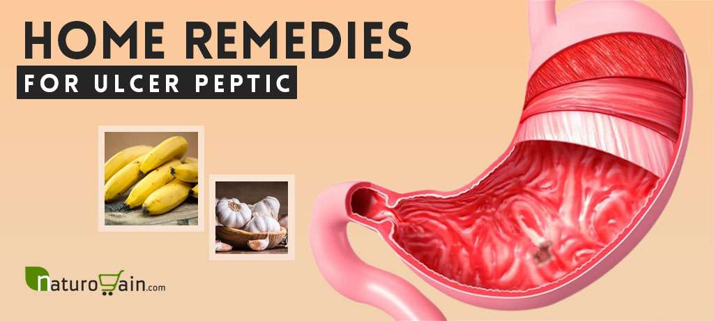 8 Best Home Remedies for Ulcer Peptic to Improve Digestion