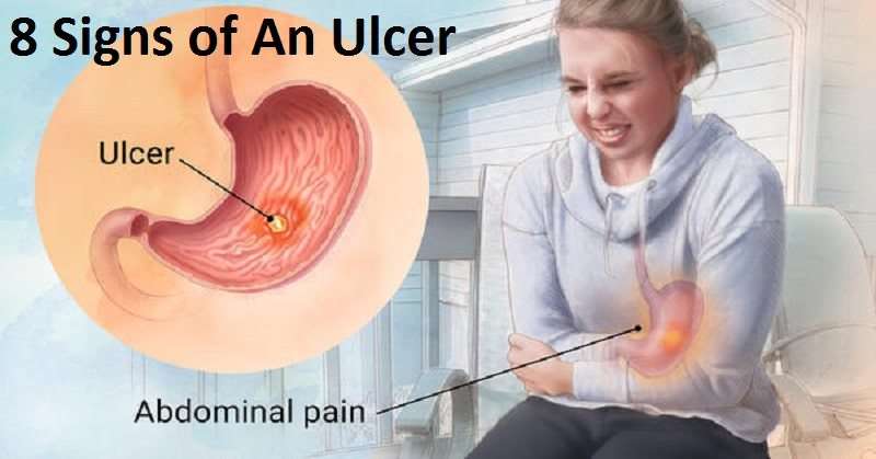 8 Signs and Symptoms of a Stomach Ulcer You Should Not Ignore ...