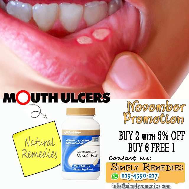 8 Tips To Ease Mouth Ulcers Pain And Discomfort