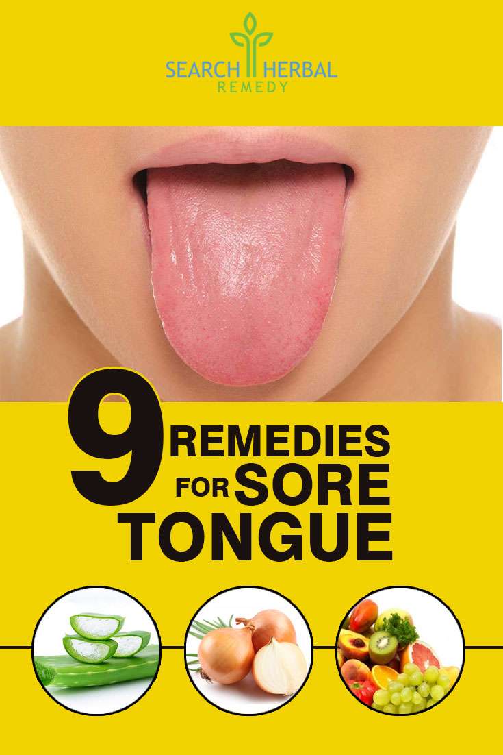 9 Wonderful Home Remedies For Sore Tongue