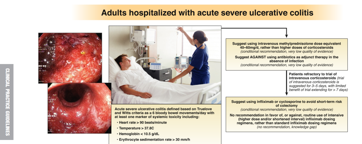 AGA Guidelines: Moderate to Severe Ulcerative Colitis
