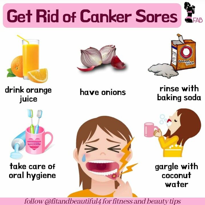 Are you troubled from canker sores or mouth sores? Than use these home ...