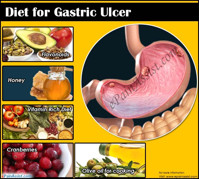 Best Diet For Ulcers In Stomach