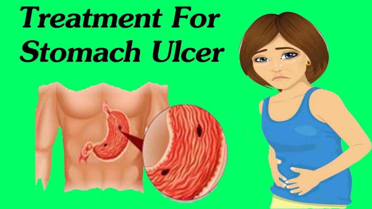 Best Way To Get Rid Of Stomach Ulcer Permanently