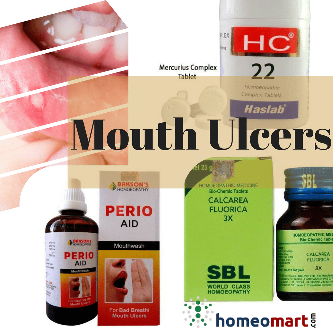 Buy Omeo Mouth Ulcer Tablets, Treats painful gum boils with Borax ...