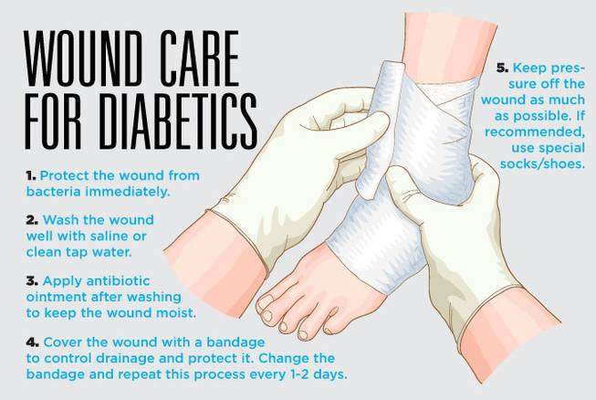 Caring for wounds and foot ulcers in diabetic patients ...