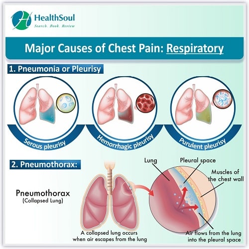Chest Pain: Causes and Treatment  Healthsoul