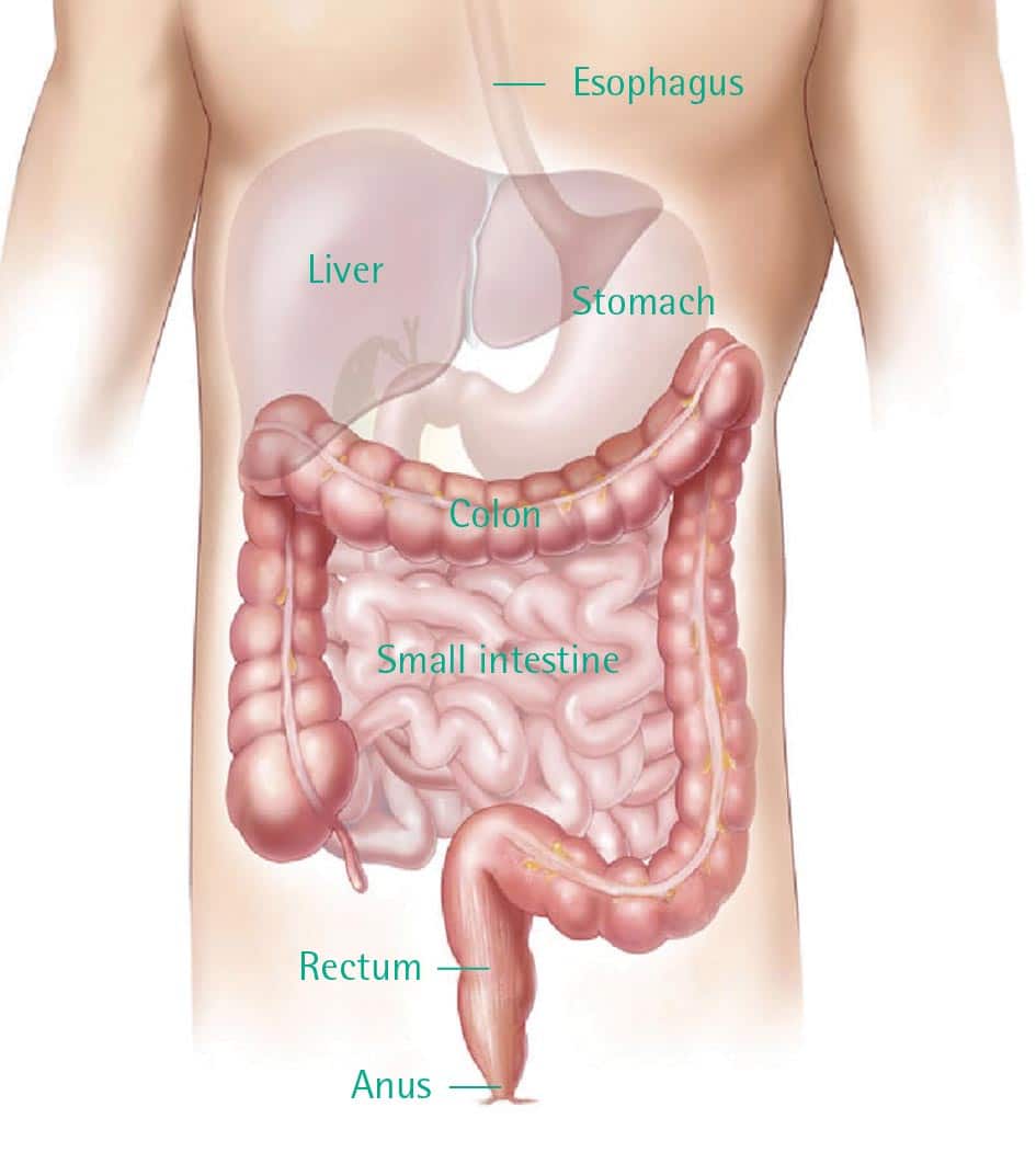 Colorectal Cancer (Colon Cancer): Signs, Diagnosis &  Treatment in ...