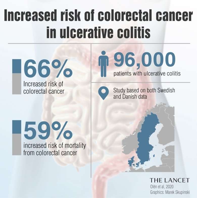 Colorectal cancer risk remains despite modern treatment for ulcerative ...