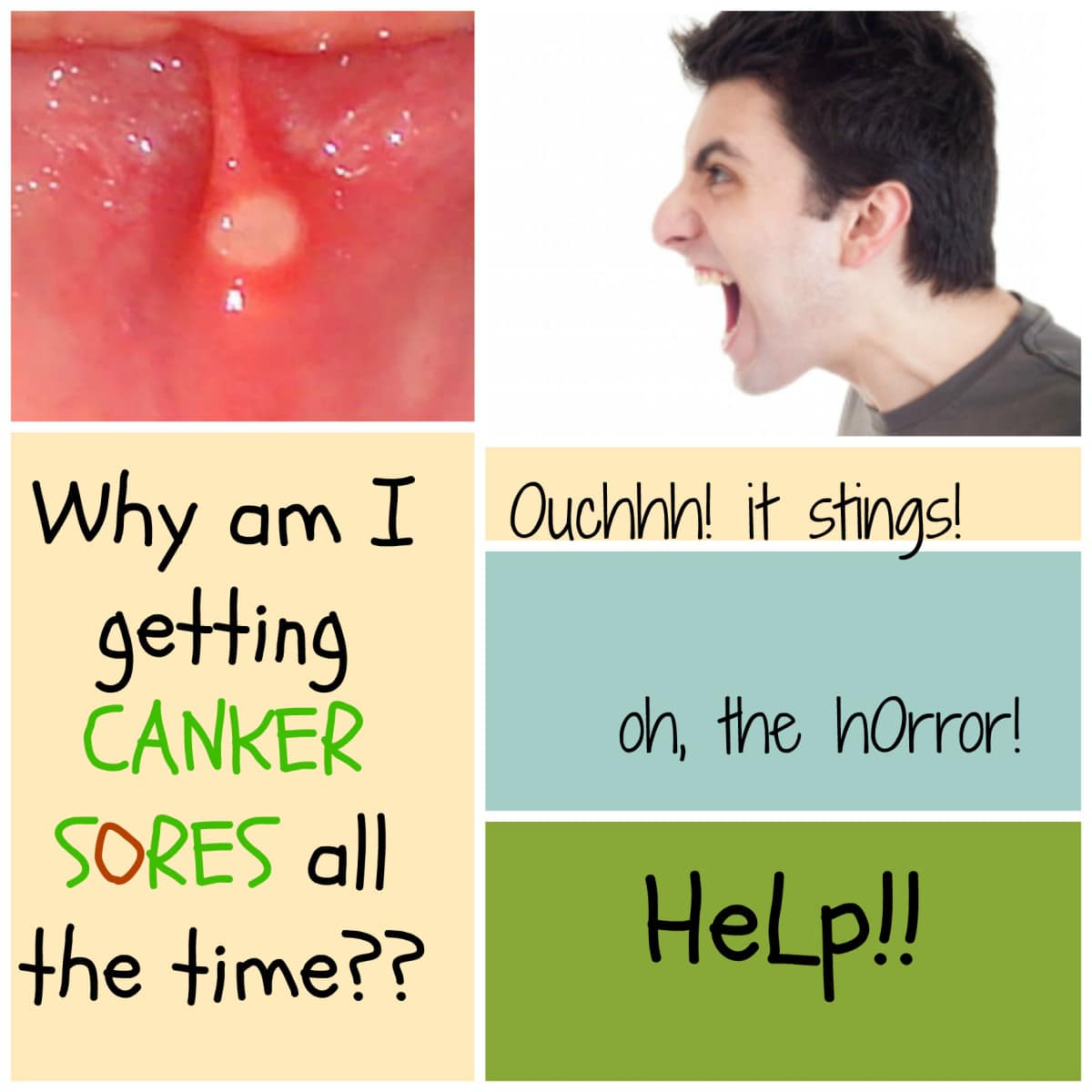 Common Causes of Canker Sores