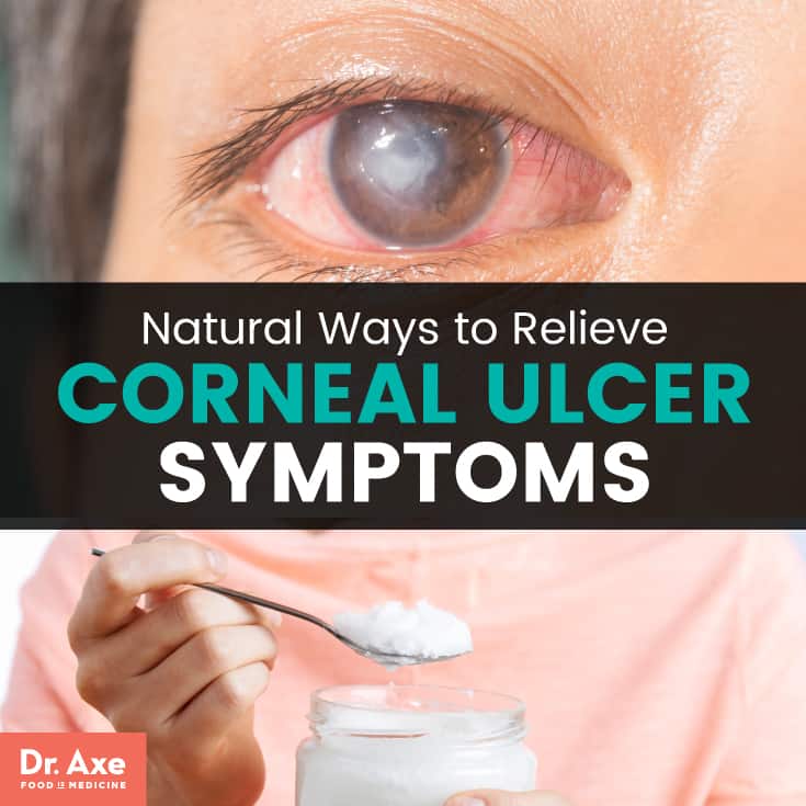 Corneal Ulcer Symptoms + Relieve Symptoms 11 Natural Ways
