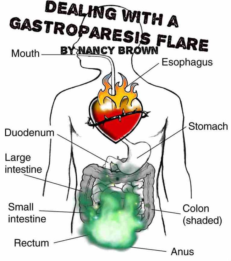 Dealing with a Gastroparesis Flare