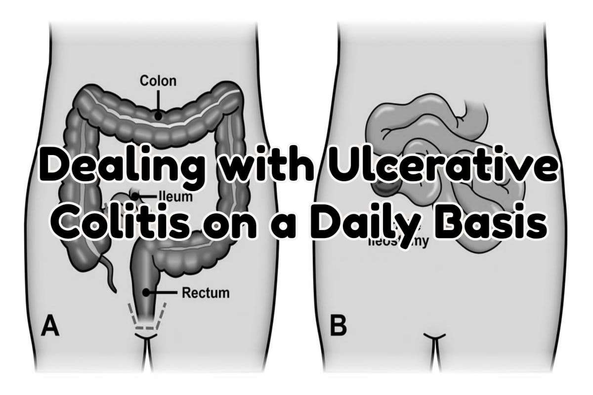 Dealing with Ulcerative Colitis on a Daily Basis