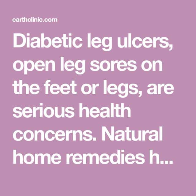 Diabetic Leg Ulcers