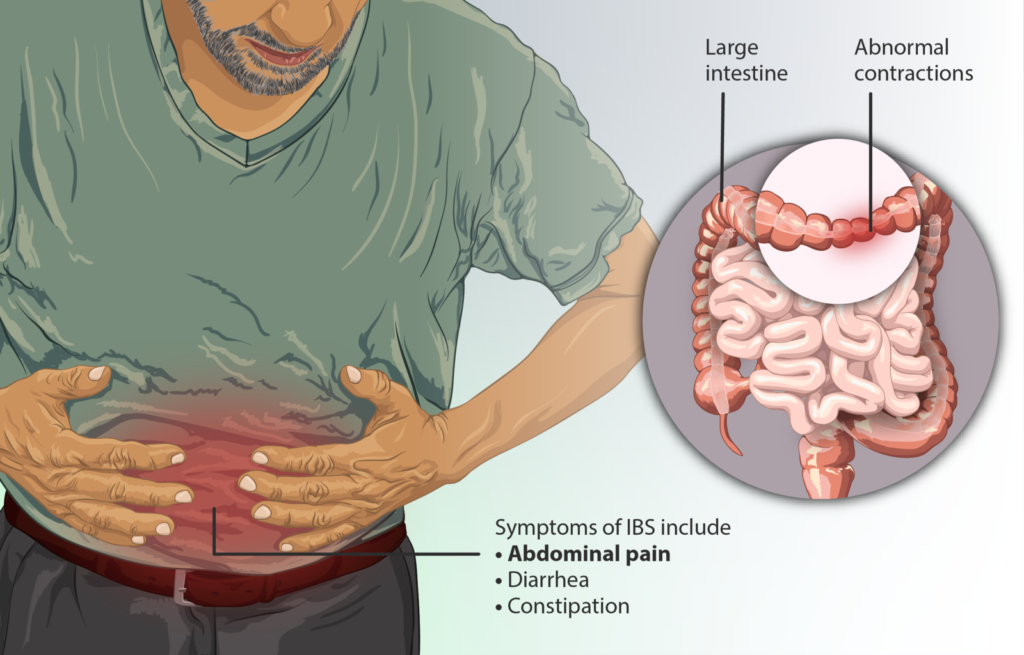 Difference Between Irritable Bowel Syndrome IBS and ...