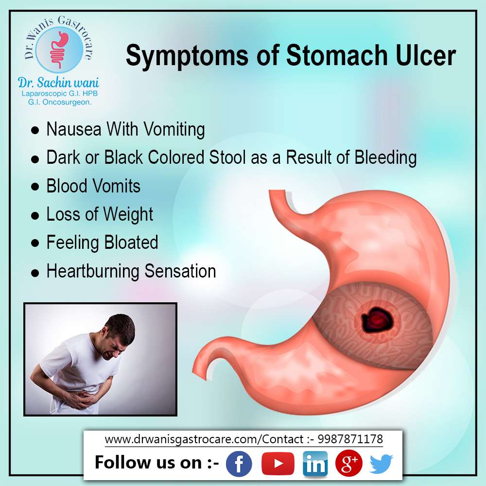Do ulcers hurt when you push on your stomach: Stomach Cancer vs ...