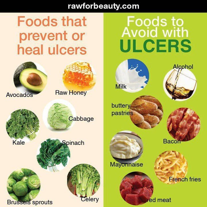 Duodenal Ulcer Diet Treatment