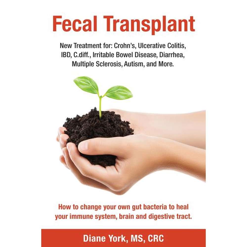 Fecal Transplant : New Treatment for Ulcerative Colitis ...