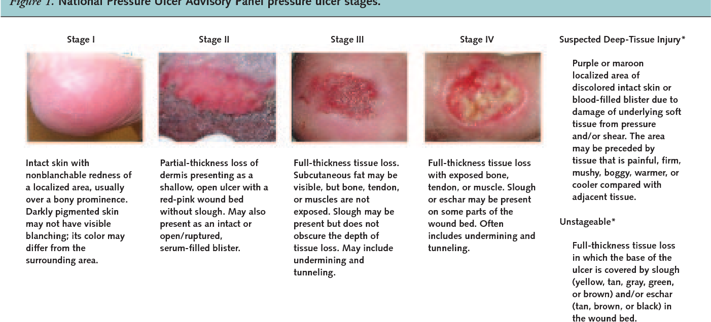 Figure 1 from Pressure ulcer treatment strategies: a systematic ...