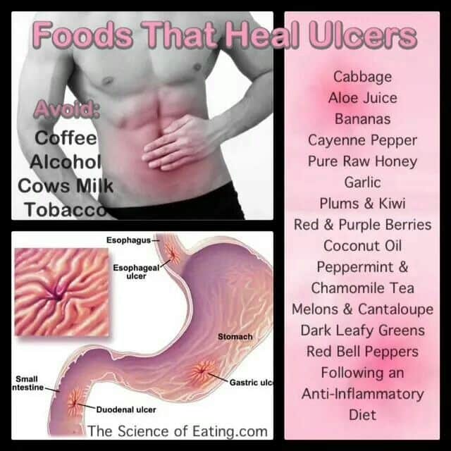 Foods that heal ulcers