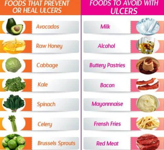 Foods to Eat and Avoid for Stomach Ulcers