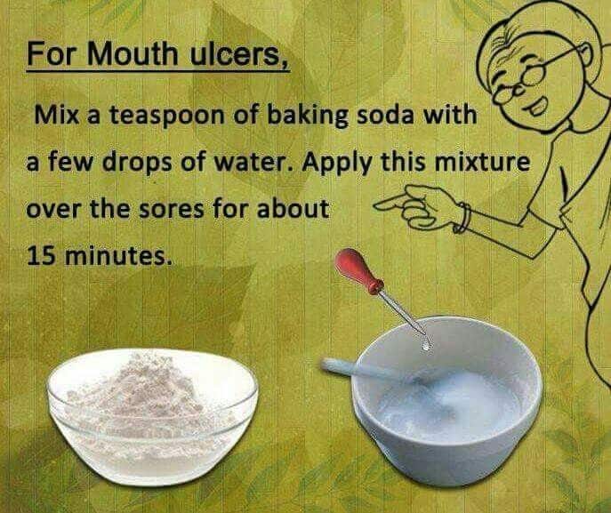 For Mouth Ulcers