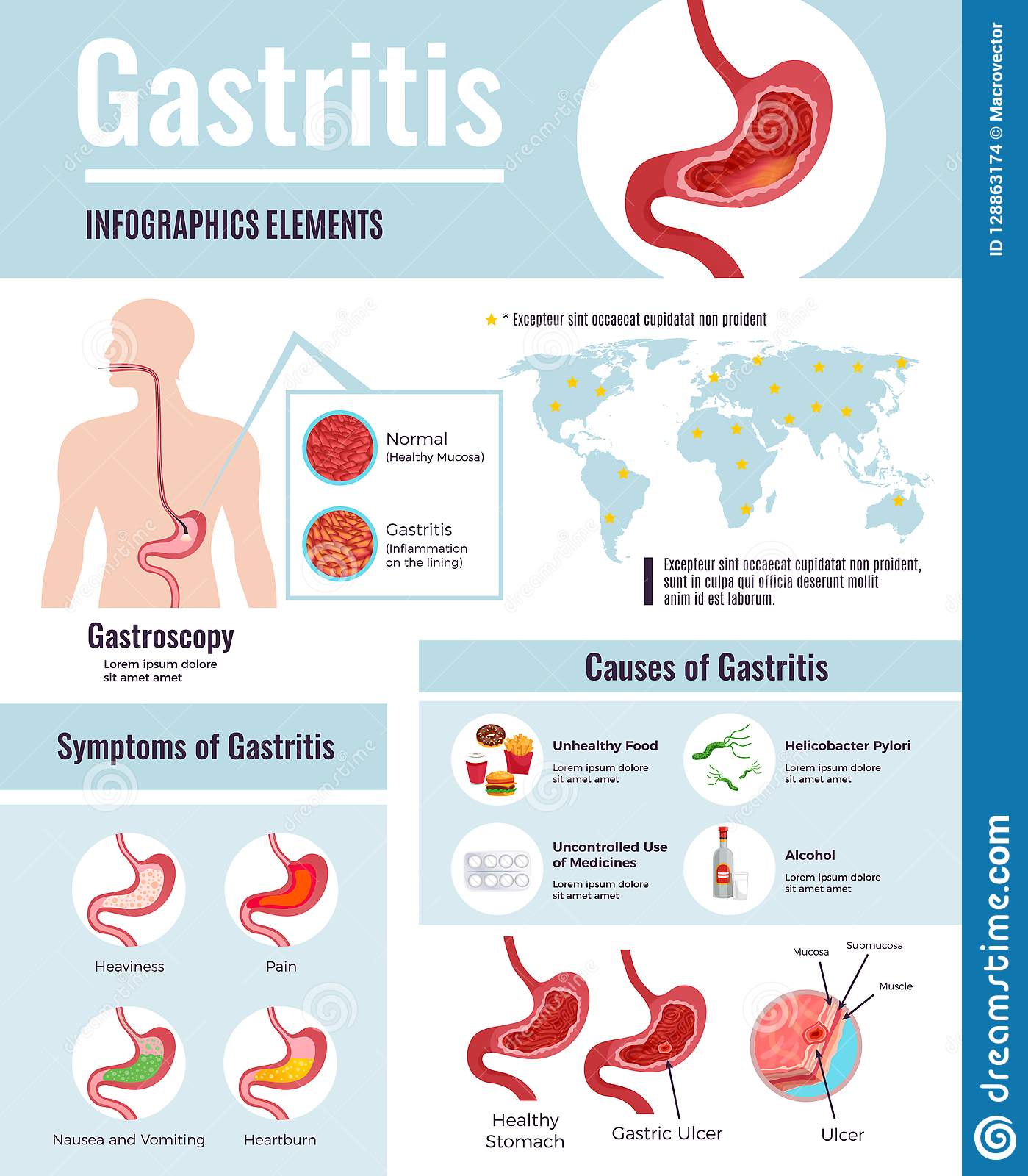 Gastritis Infographic Poster Stock Vector
