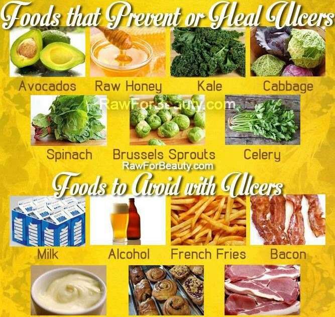 Gastritis Stomach Ulcer Diet Food List