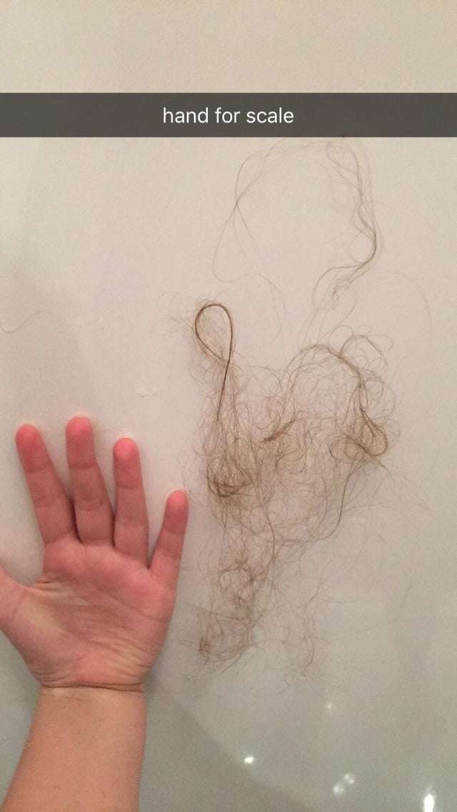 Hair loss?? Do you guys lose this much hair?? this was ...