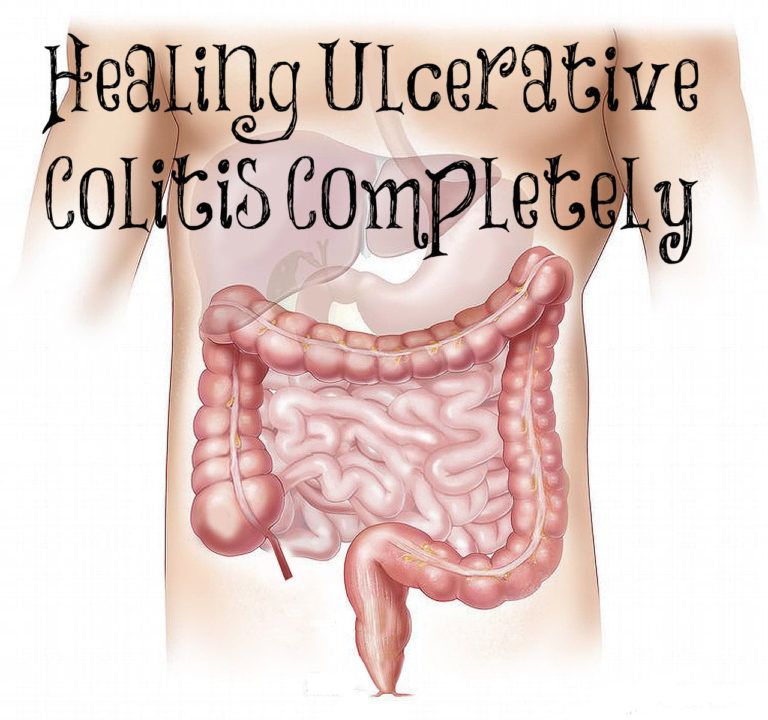 Healing Ulcerative Colitis Completely