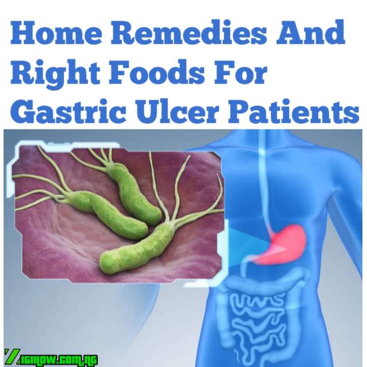HOME REMEDIES AND RIGHT FOODS FOR GASTRIC ULCER PATIENTS ...