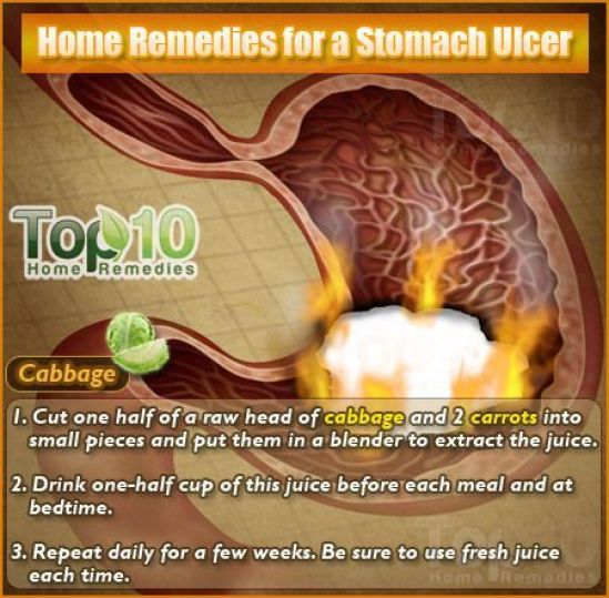 Home Remedies for a Stomach Ulcer #JointPainrelief in 2020