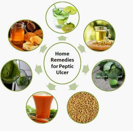 Home Remedies For Peptic Ulcer