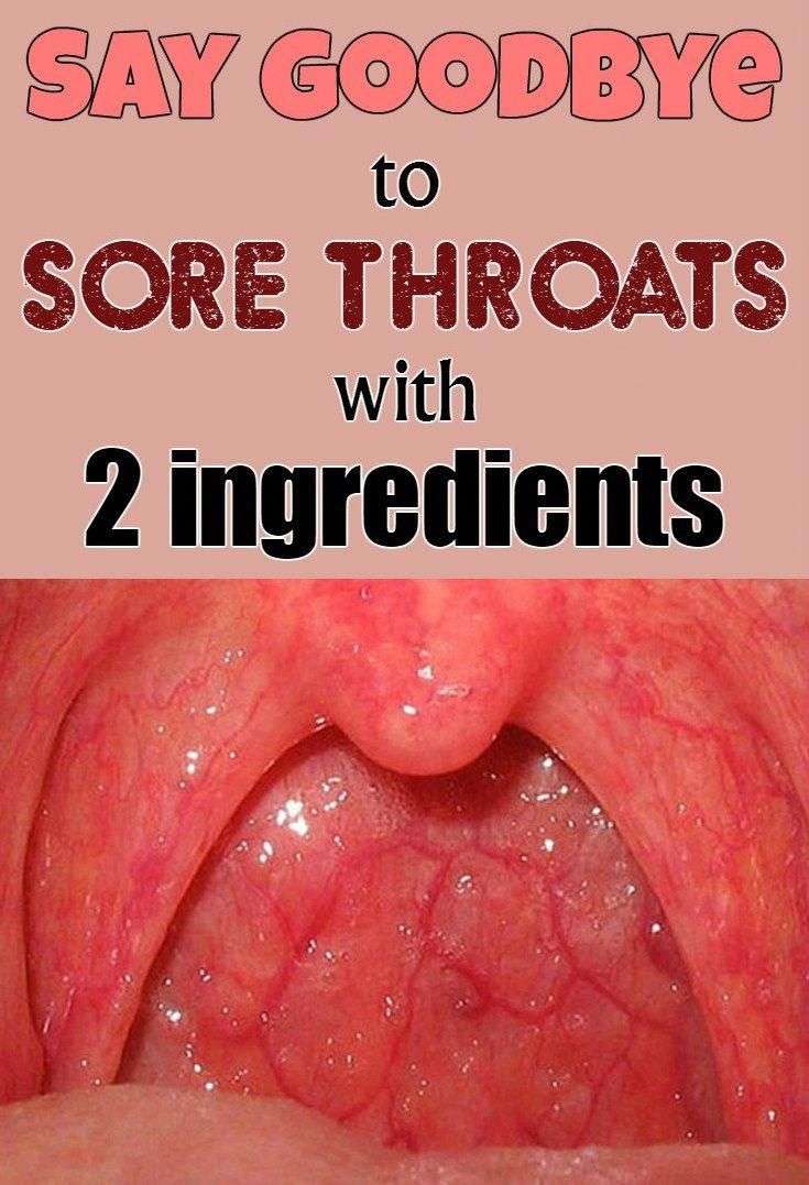 Home Remedies to counter Throat, Skin,Eye,Sinus Infections in 2020 ...