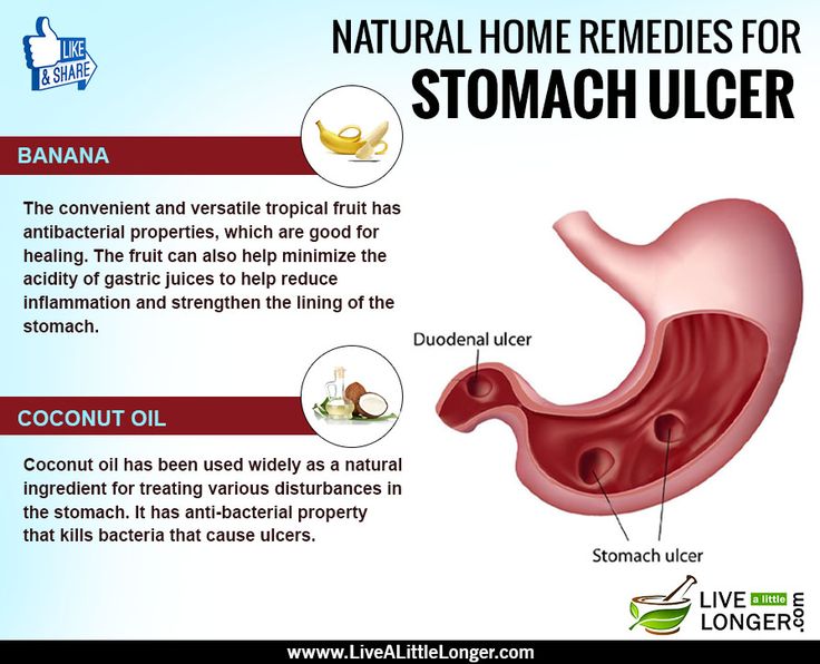 How Do You Treat An Ulcer