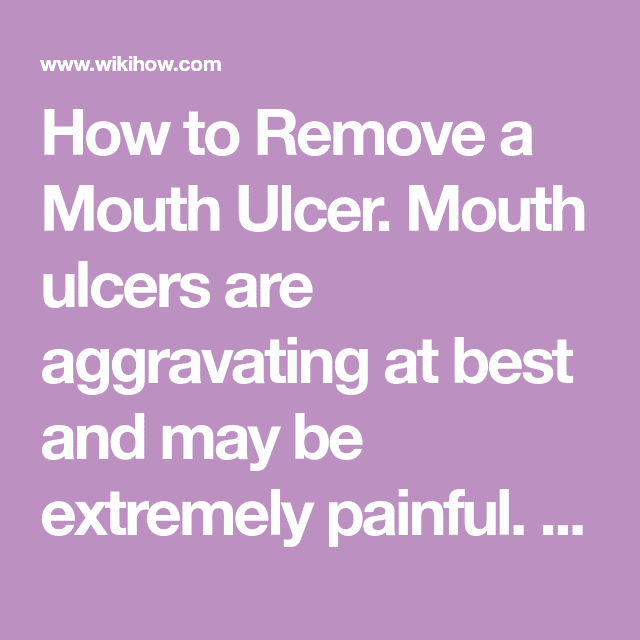 How to Remove a Mouth Ulcer