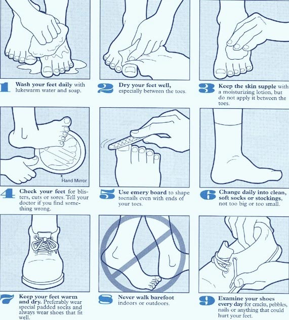 How To Take Care of Your Feet  ACE Diabetes