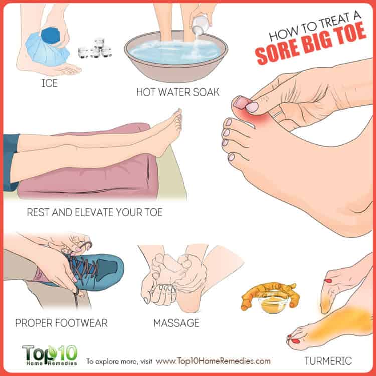 How to Treat a Sore Big Toe